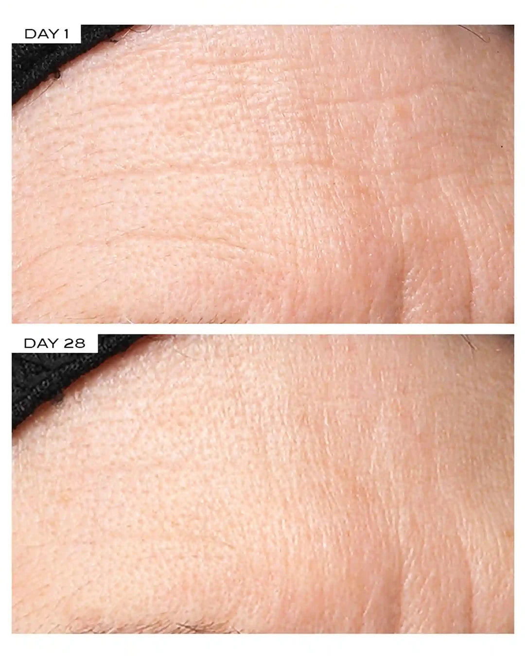 Before and after comparison of skin texture on Day 1 and Day 28.