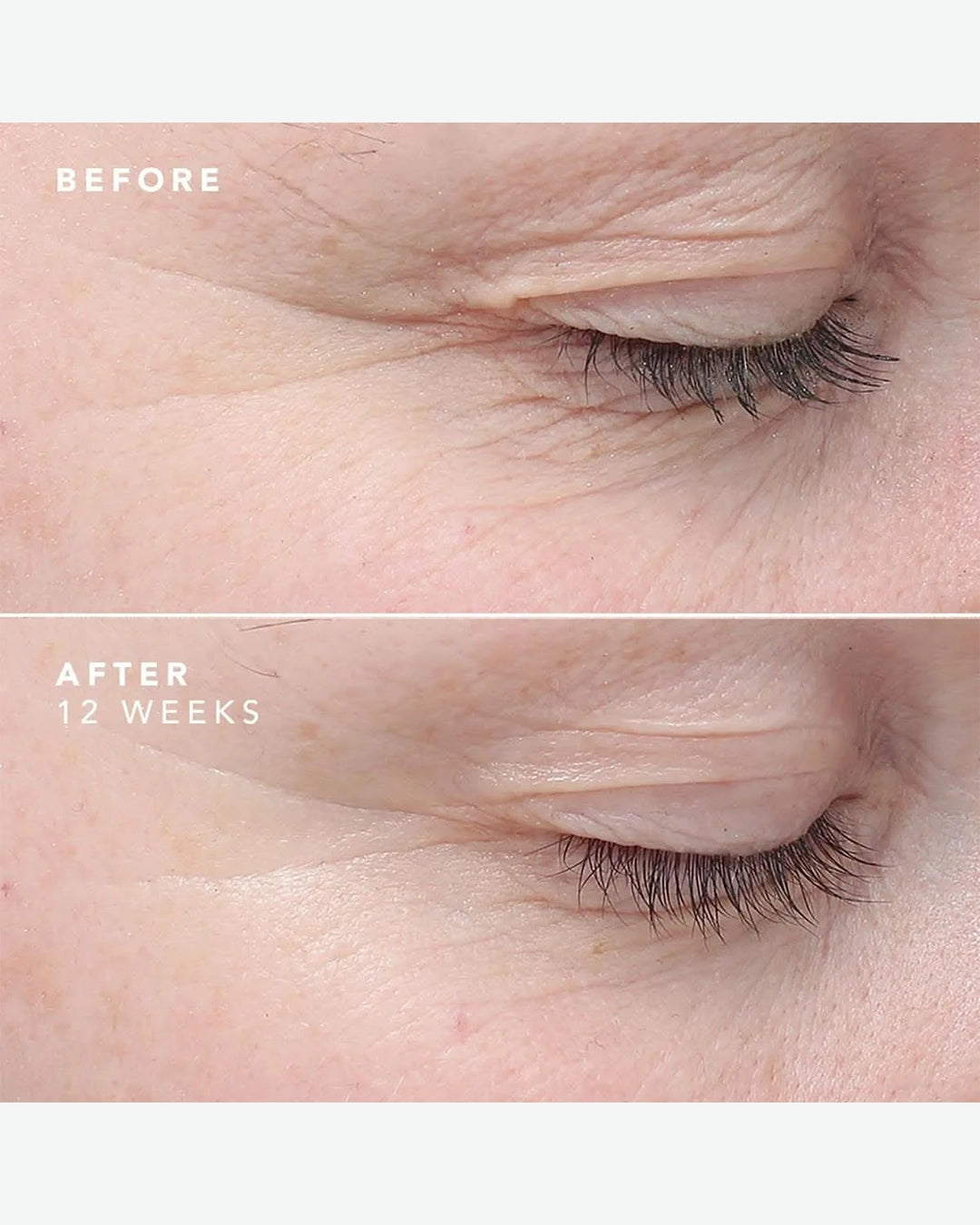 Before and after comparison of eye area skin texture with text indicating 12 weeks difference.