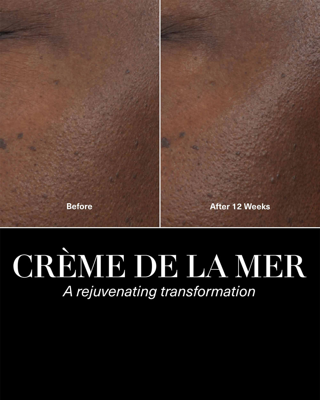 Before and after comparison of skin treatment with 'Crème de la Mer' branding.