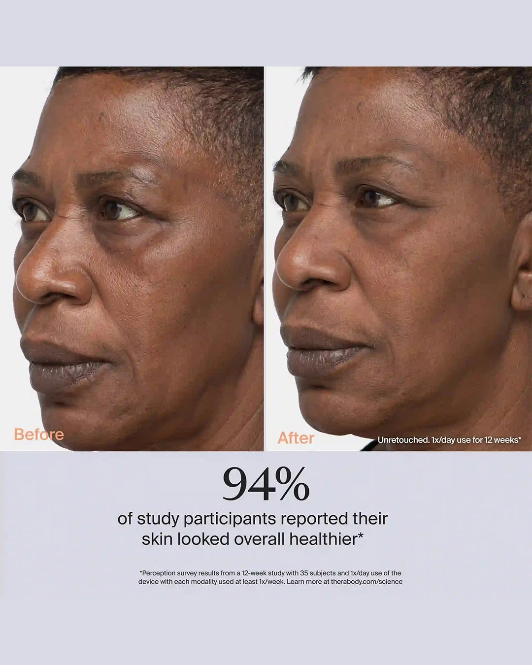 Before and after comparison of a woman's face with text indicating skin health improvement.