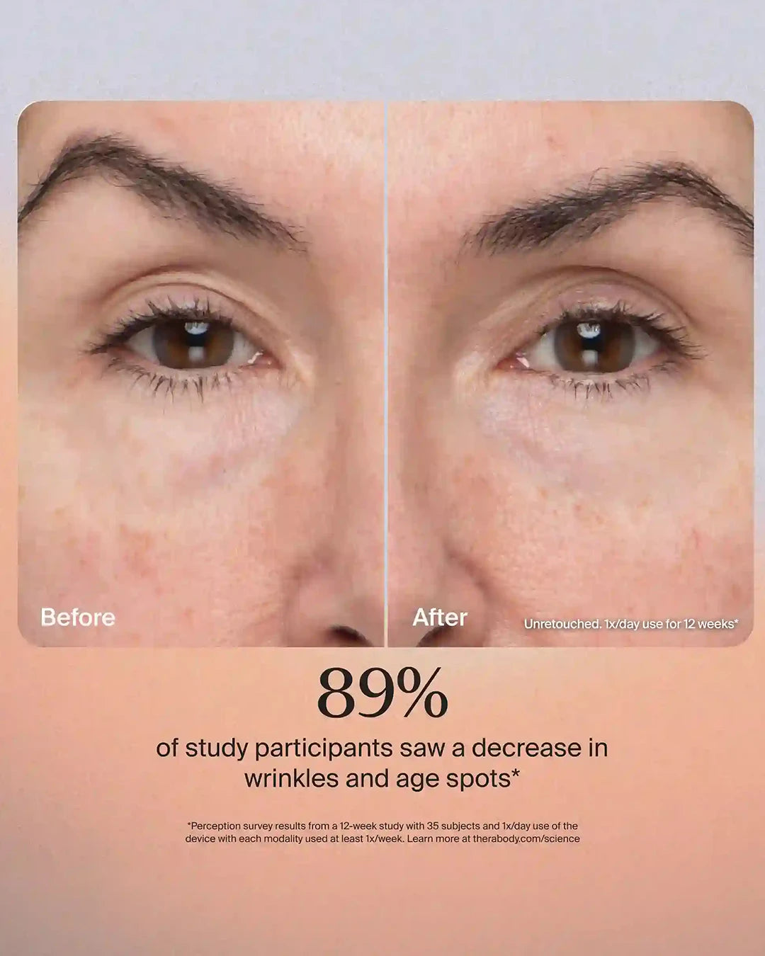 Before and after comparison of skin with text indicating 89% decrease in wrinkles and age spots.