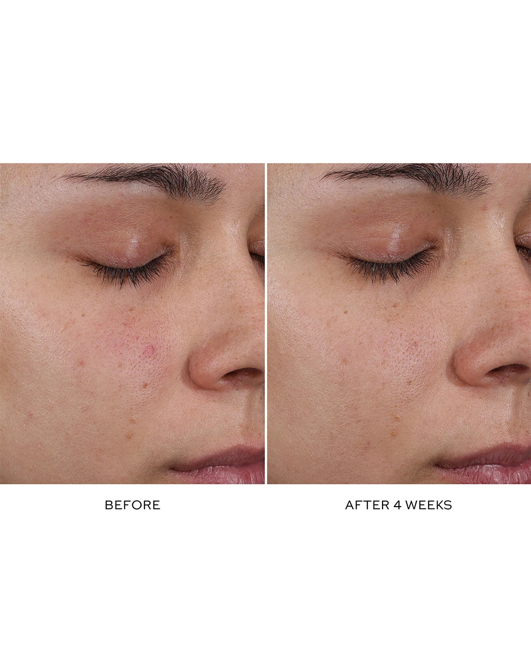 Pore Refining Complex