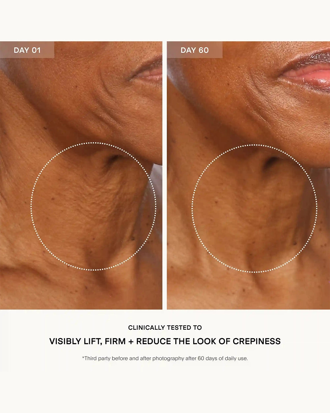 Before and after comparison of skin texture on a person's neck, showing visible improvement over 60 days.