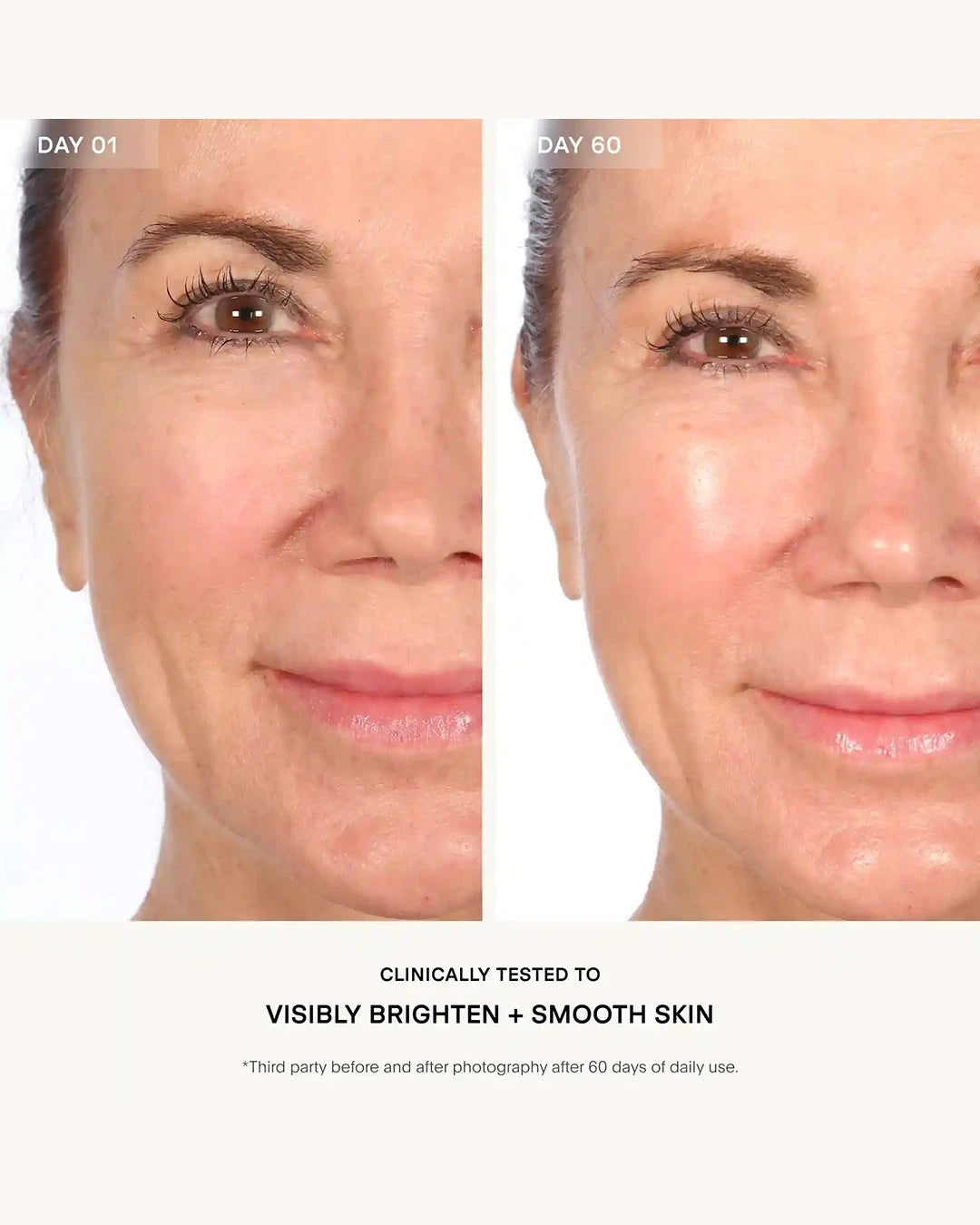 Before and after comparison of a woman's face with text indicating clinically tested results.