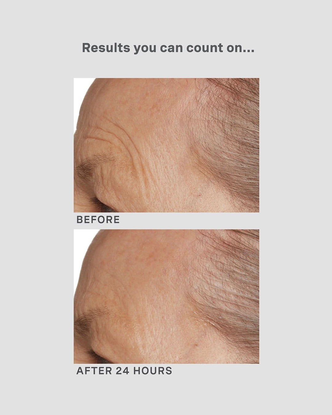 Before and after comparison of skin texture with text 'Results you can count on...' and 'After 24 Hours'.