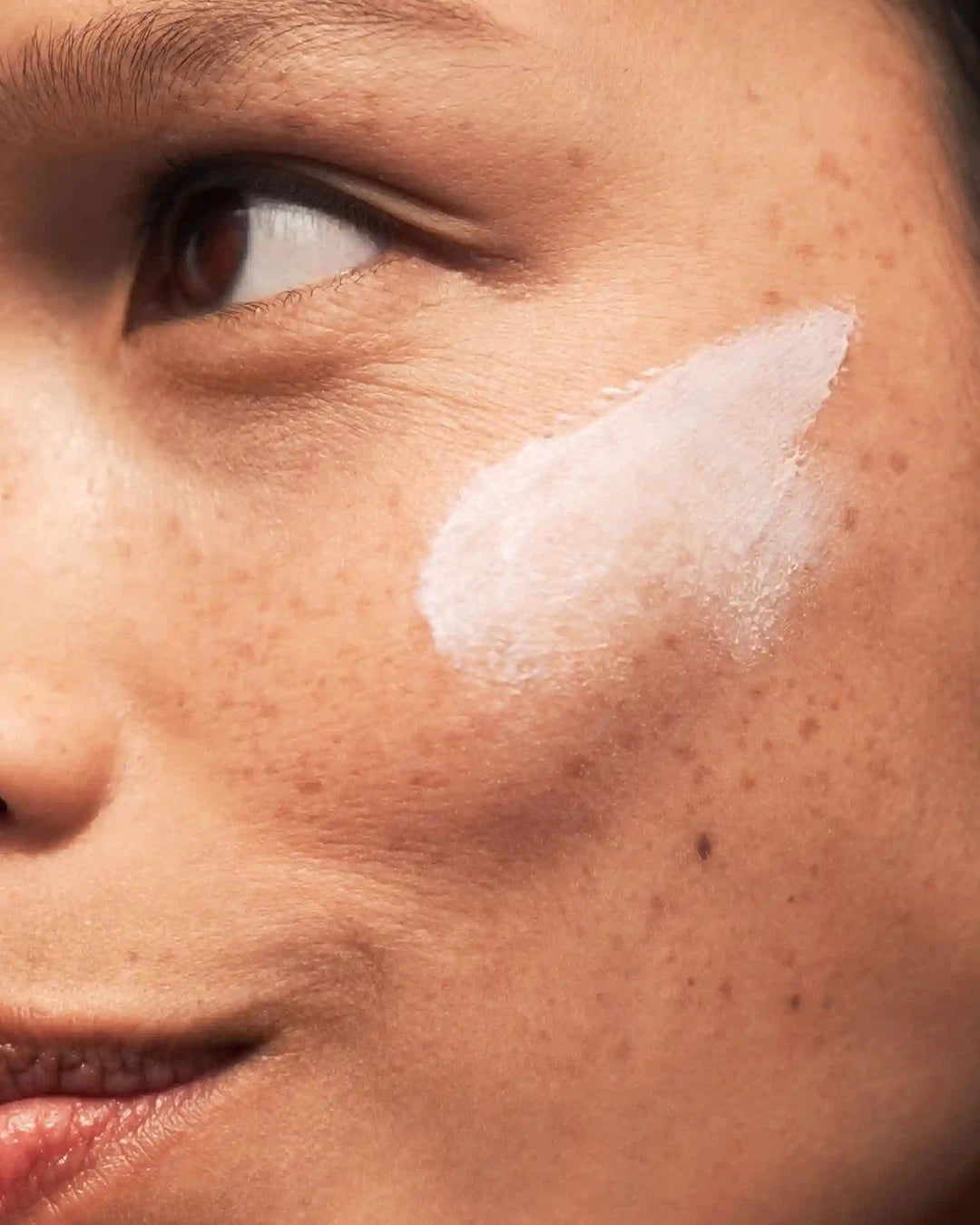 Close-up of a person's face with a white patch on their cheek