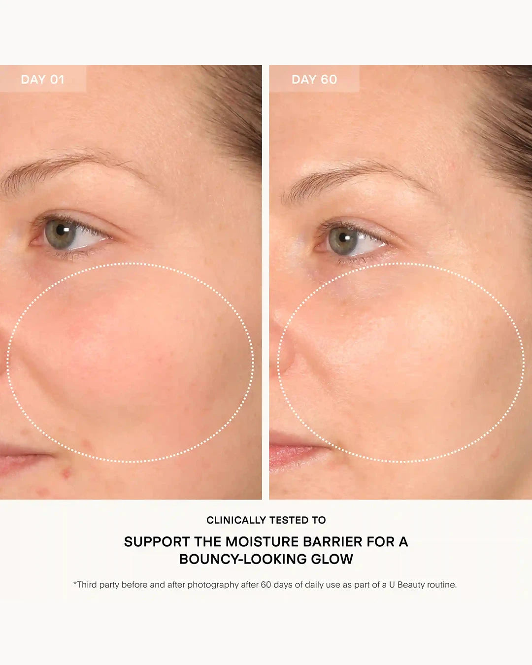 Before and after comparison of a person's eye area with text about clinical testing for moisture barrier support.