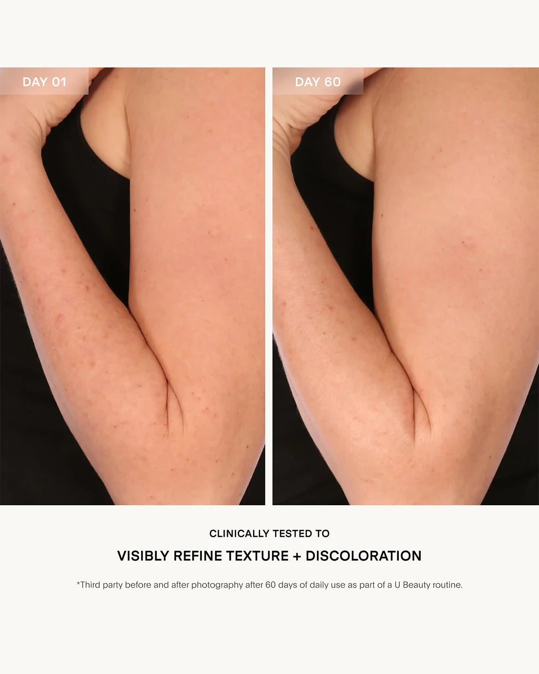 Before and after comparison of skin texture on a person's arm, showing visible improvement over 60 days.