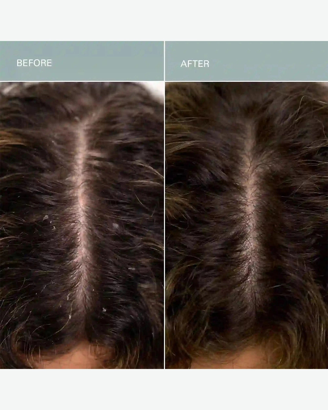 Before and after comparison of hair treatment on a person's head.