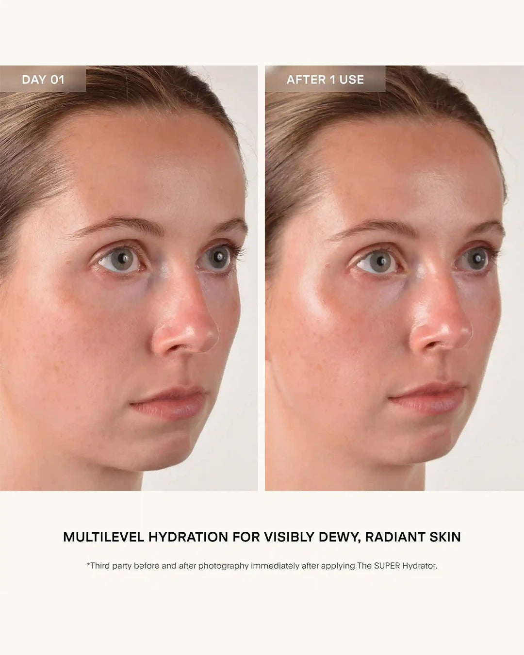 Before and after comparison of a person's face with text about multilevel hydration for dewy, radiant skin.