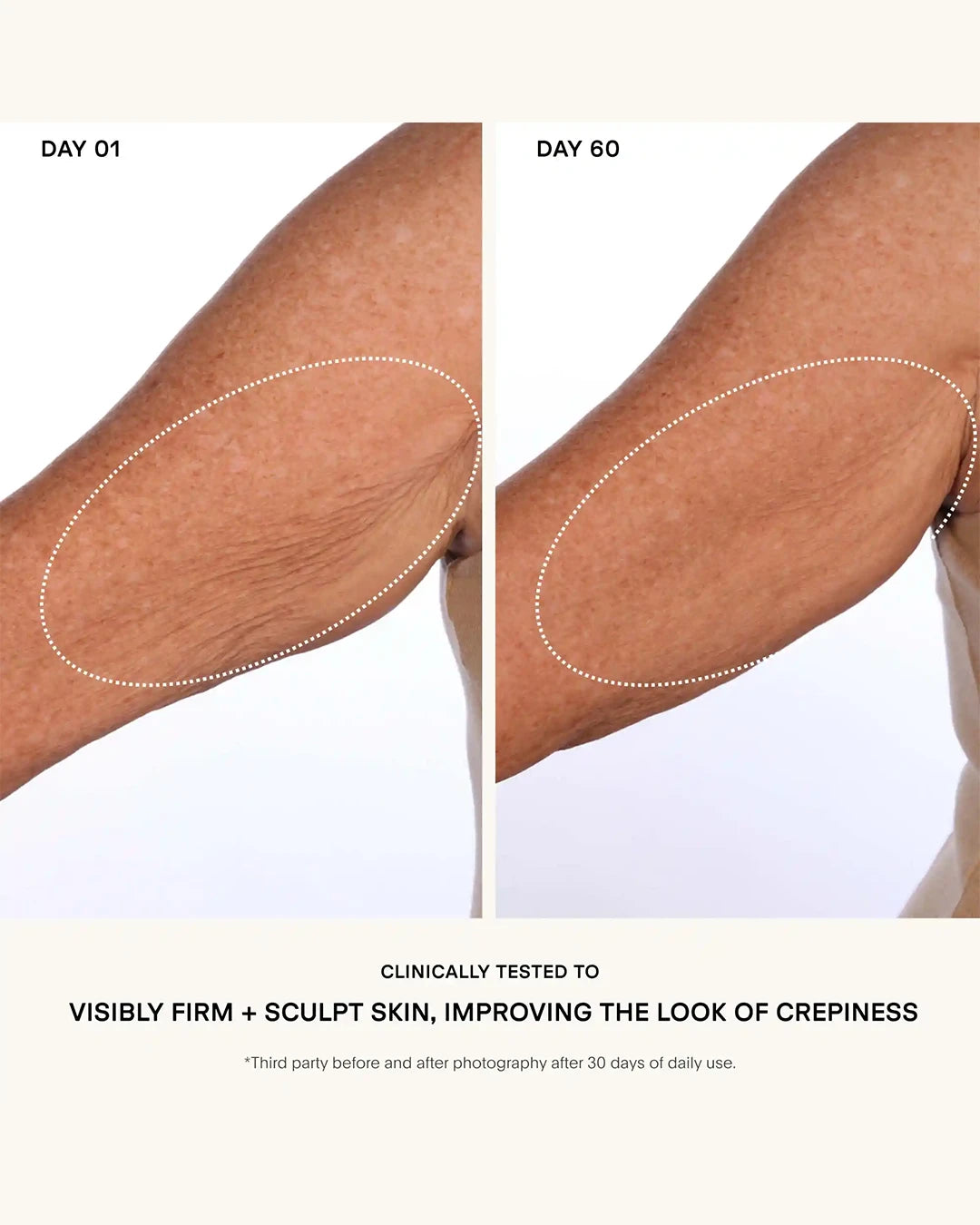 Before and after comparison of a person's leg showing skin firming and sculpting effects over 60 days.