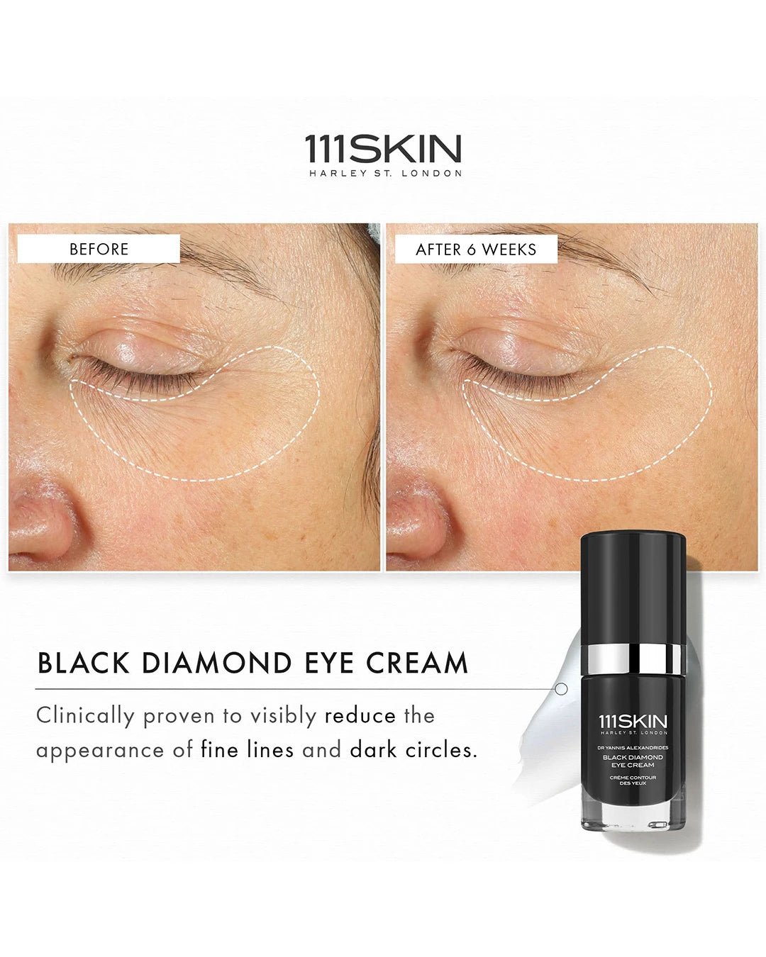 Black Diamond Eye Cream