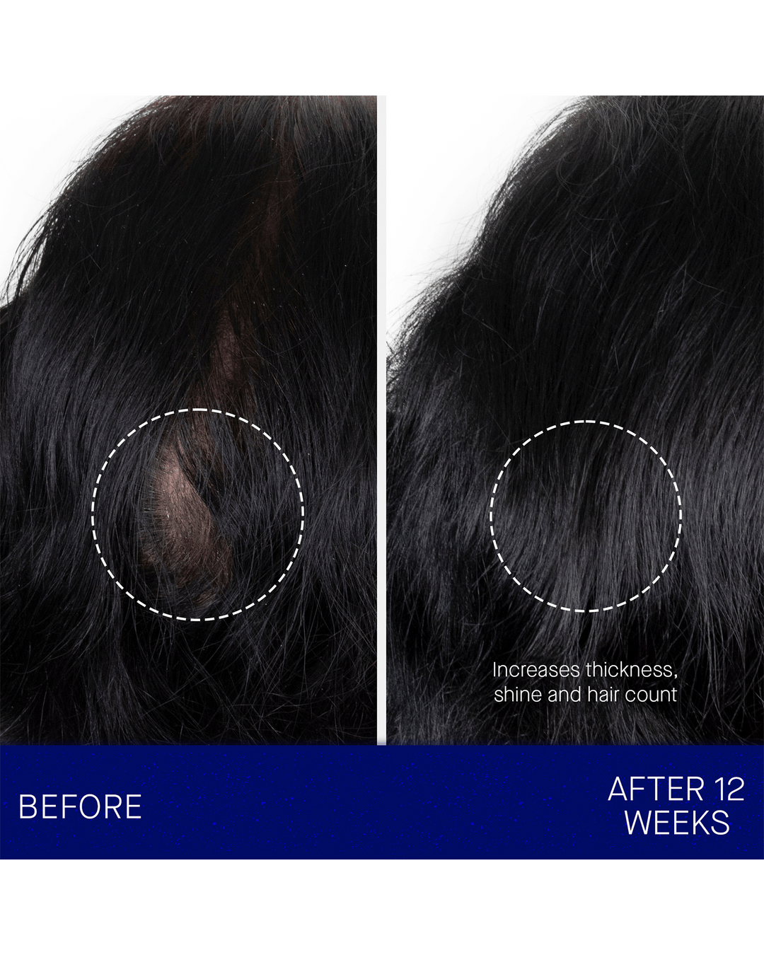 A side-by-side comparison chart showing a specific section of black hair "Before" and "After 12 Weeks," with text noting it increases thickness, shine, and hair count.
