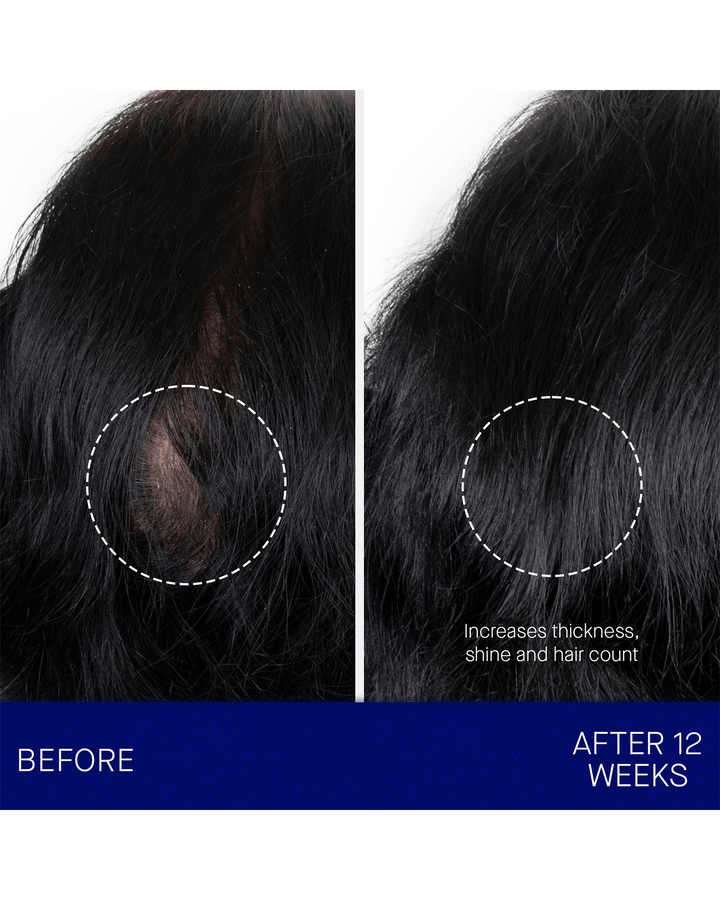 A side-by-side comparison chart showing a specific section of black hair "Before" and "After 12 Weeks," with text noting it increases thickness, shine, and hair count.