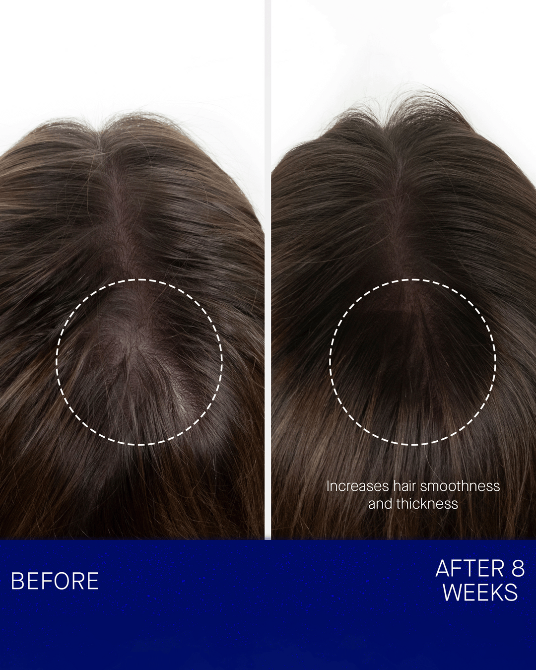 A side-by-side comparison image of the top of a person's head showing hair before and after 8 weeks, with text noting increases in hair smoothness and thickness.