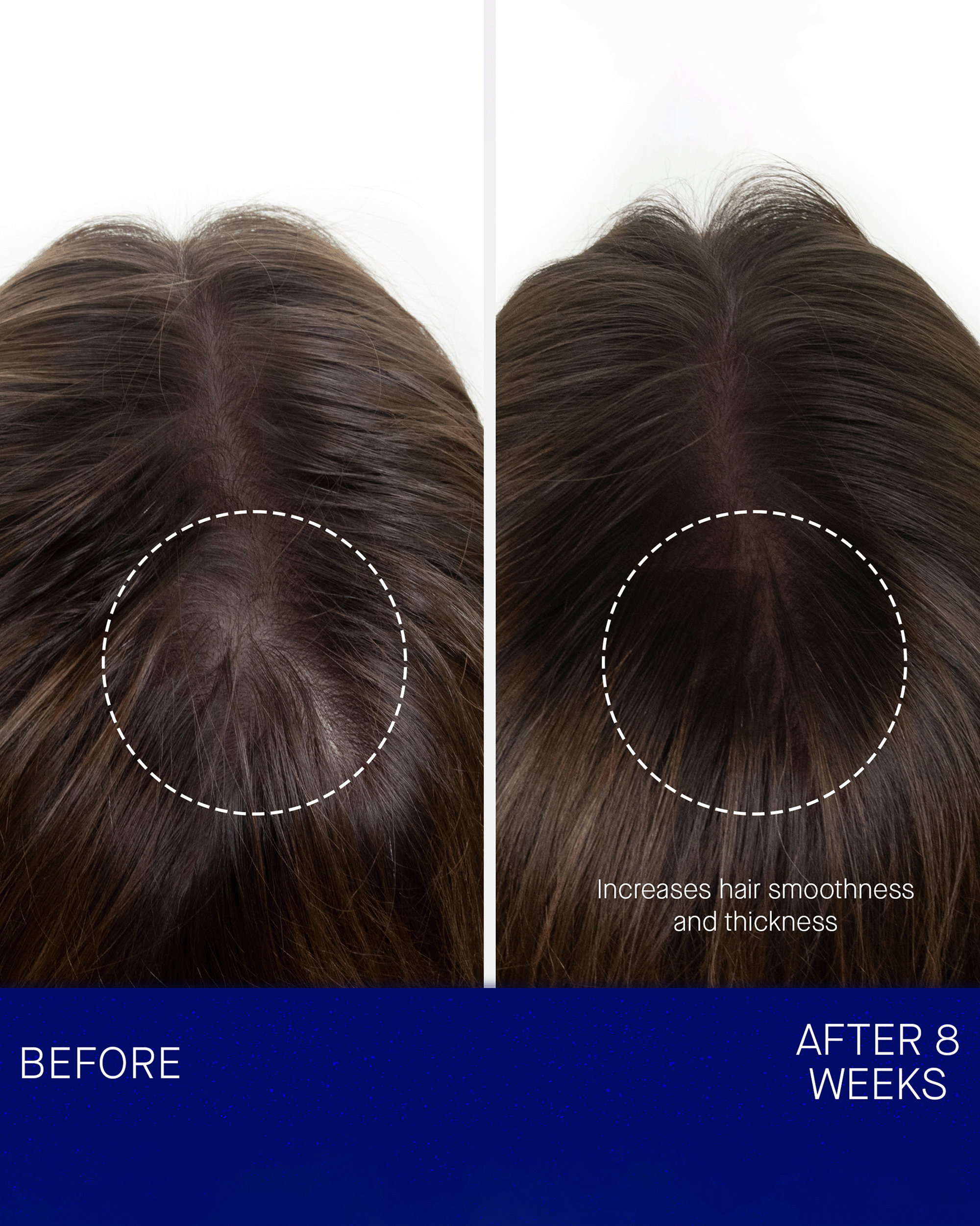 A side-by-side comparison image of the top of a person's head showing hair before and after 8 weeks, with text noting increases in hair smoothness and thickness.