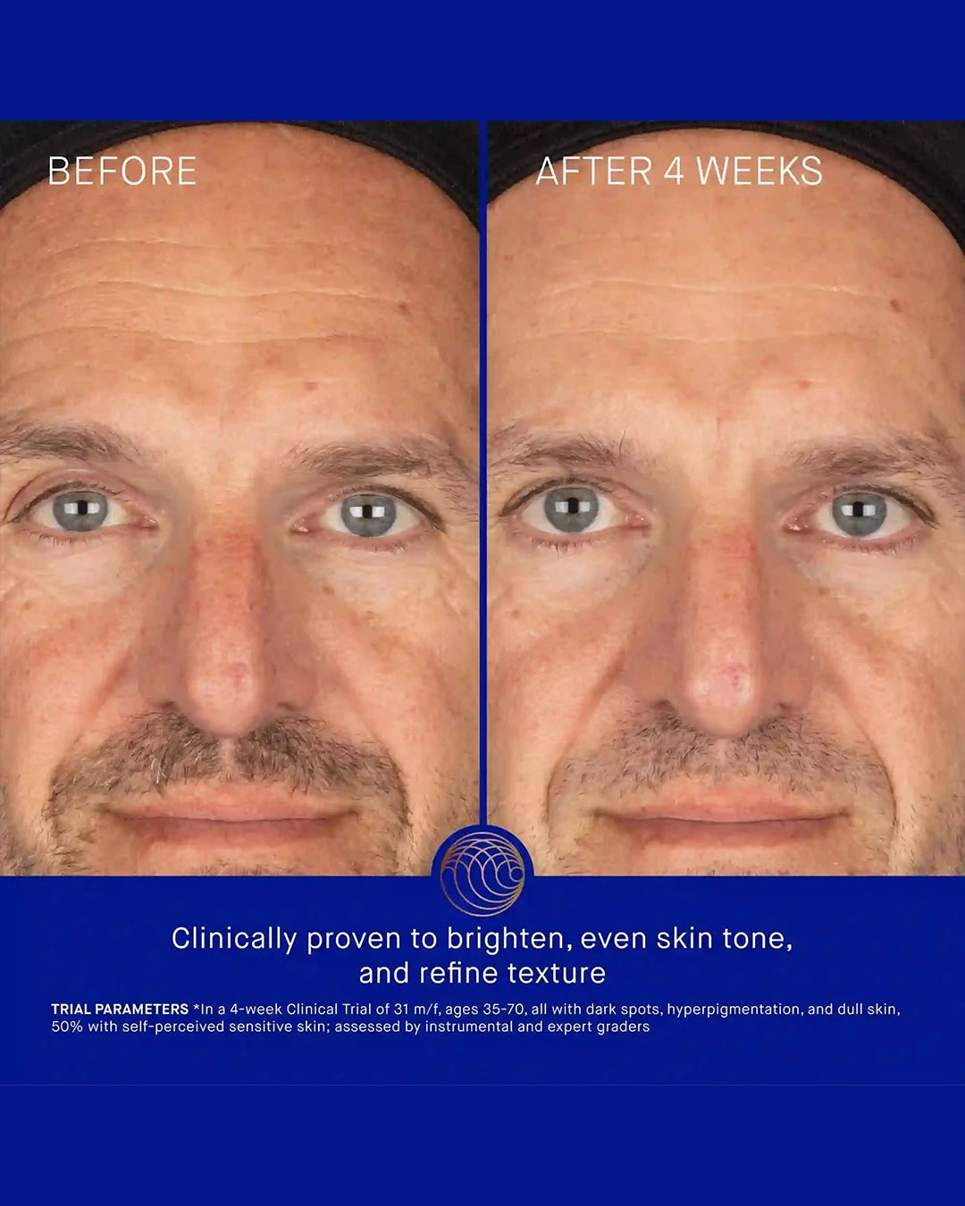 Before and after comparison of a man's face with text indicating clinical proven benefits.