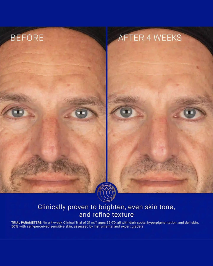 Before and after comparison of a man's face with text indicating clinical proven benefits.
