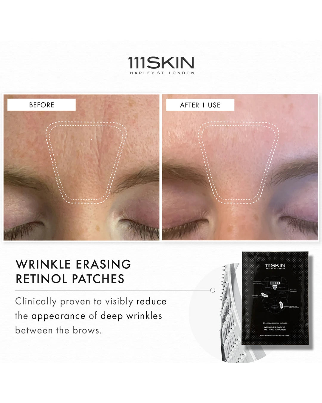 Wrinkle Erasing Retinol Patches