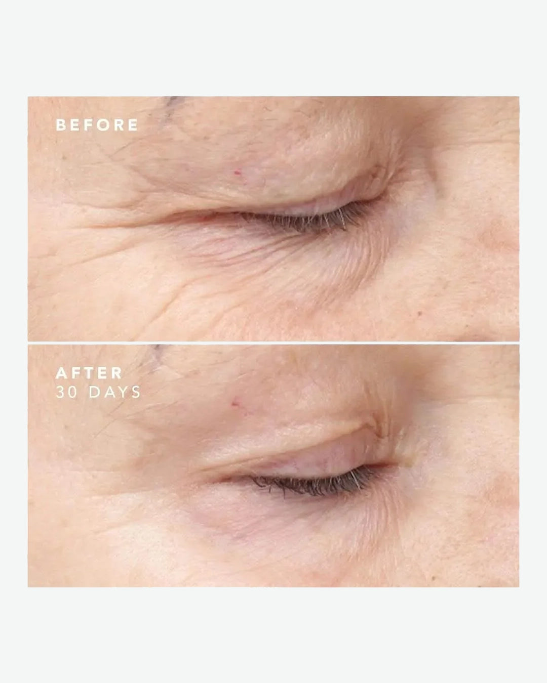 30 Day Treatment