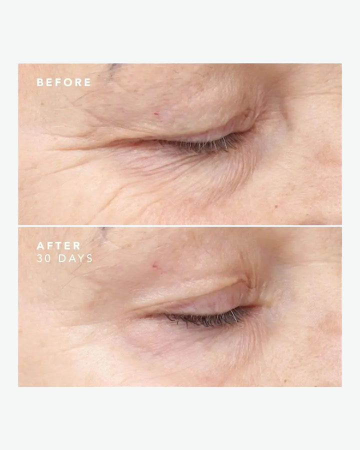 30 Day Treatment