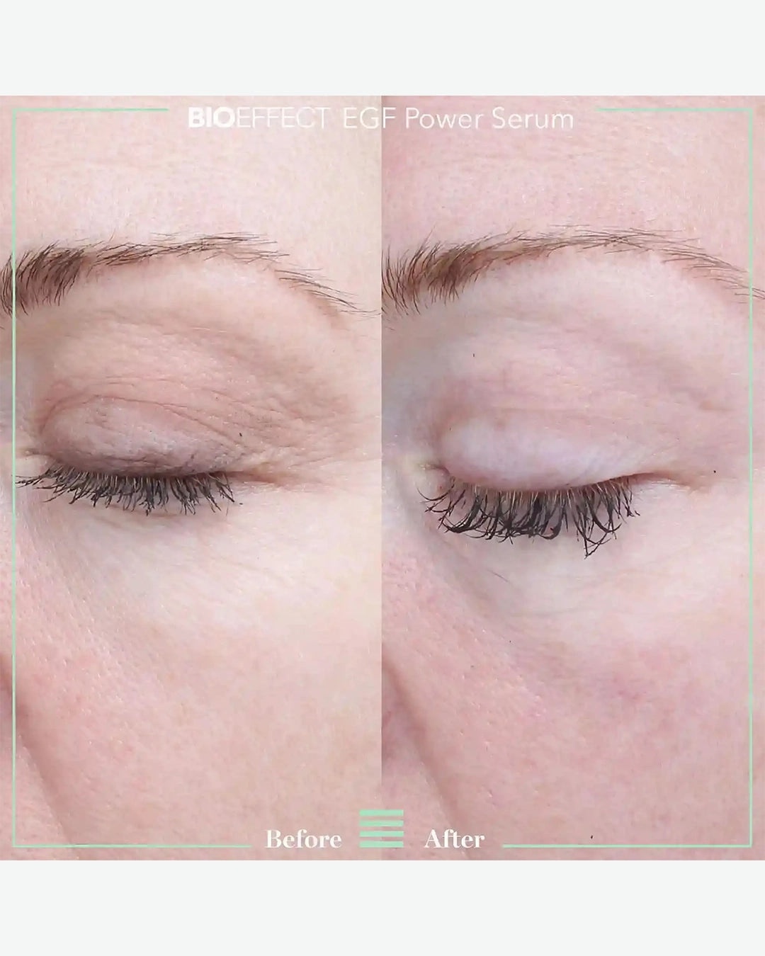 Egf Power Serum