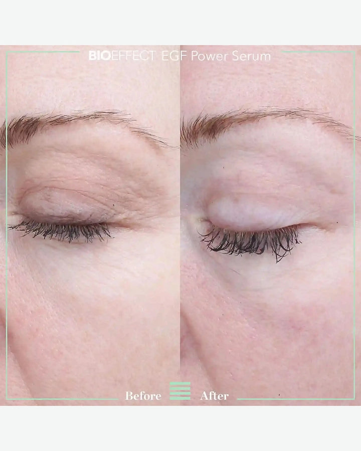 Egf Power Serum