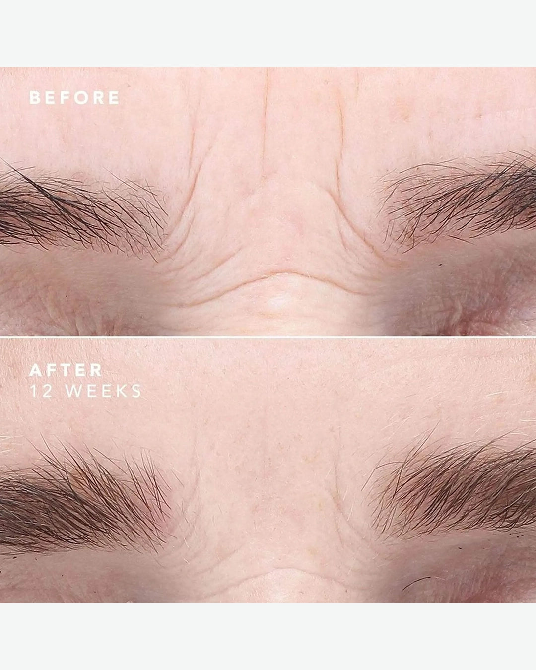 Egf Serum