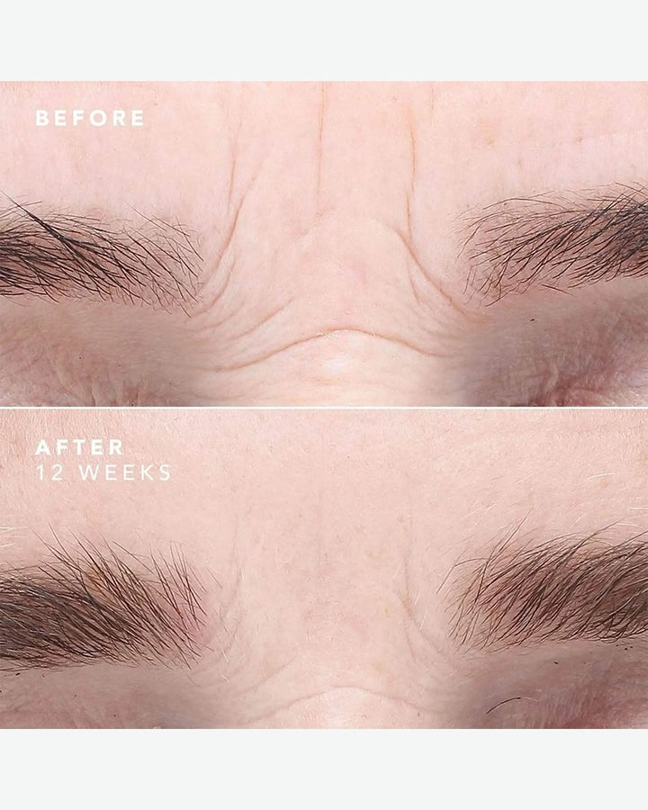Egf Serum