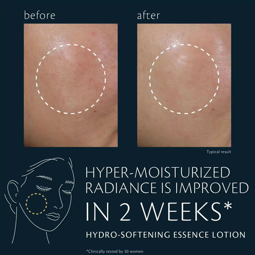 Hydro-softening Essence Lotion