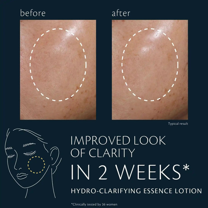 Hydro-clarifying Essence Lotion