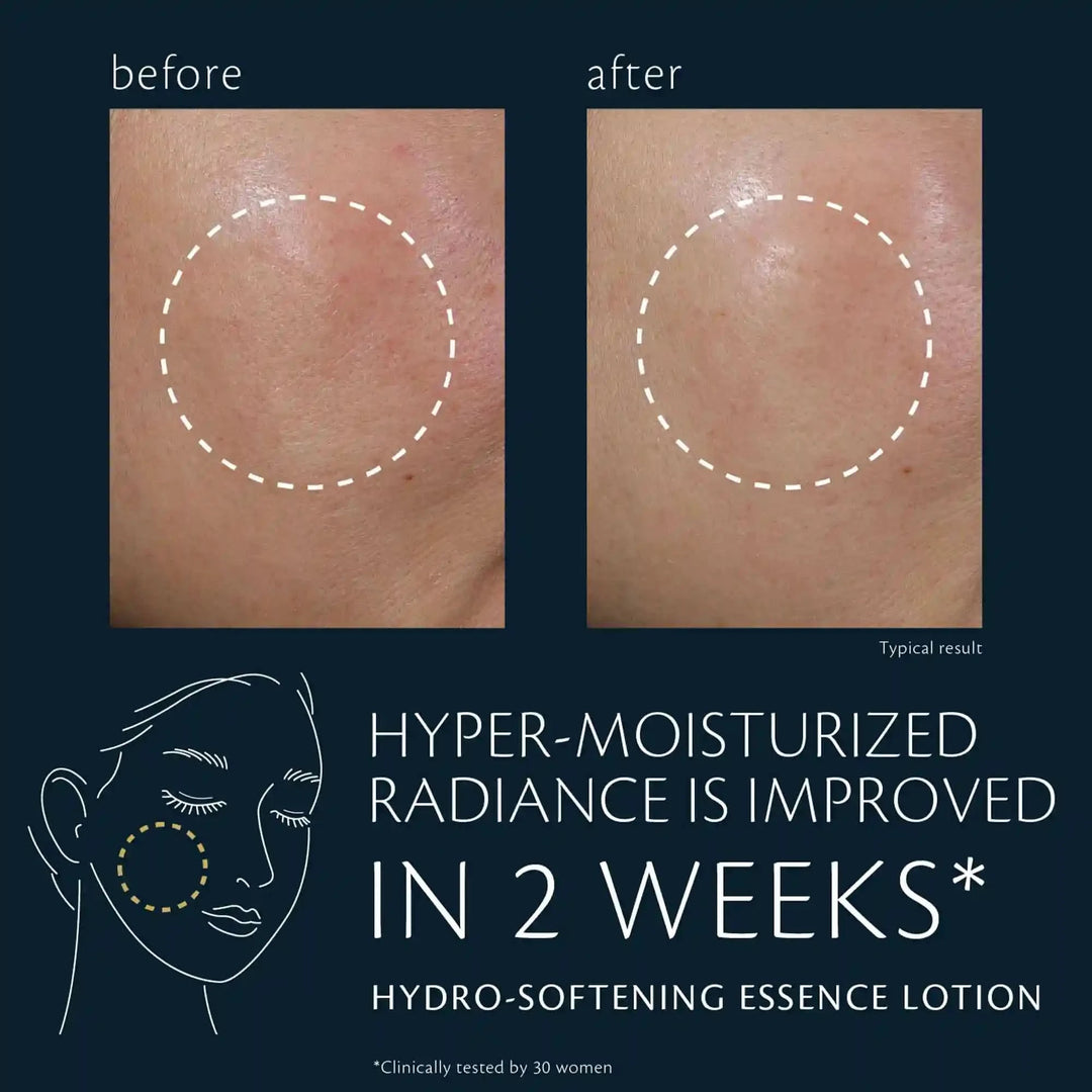 Hydro-Softening Essence Lotion Mini