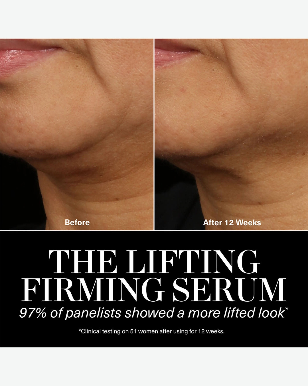 Lifting Firming Serum