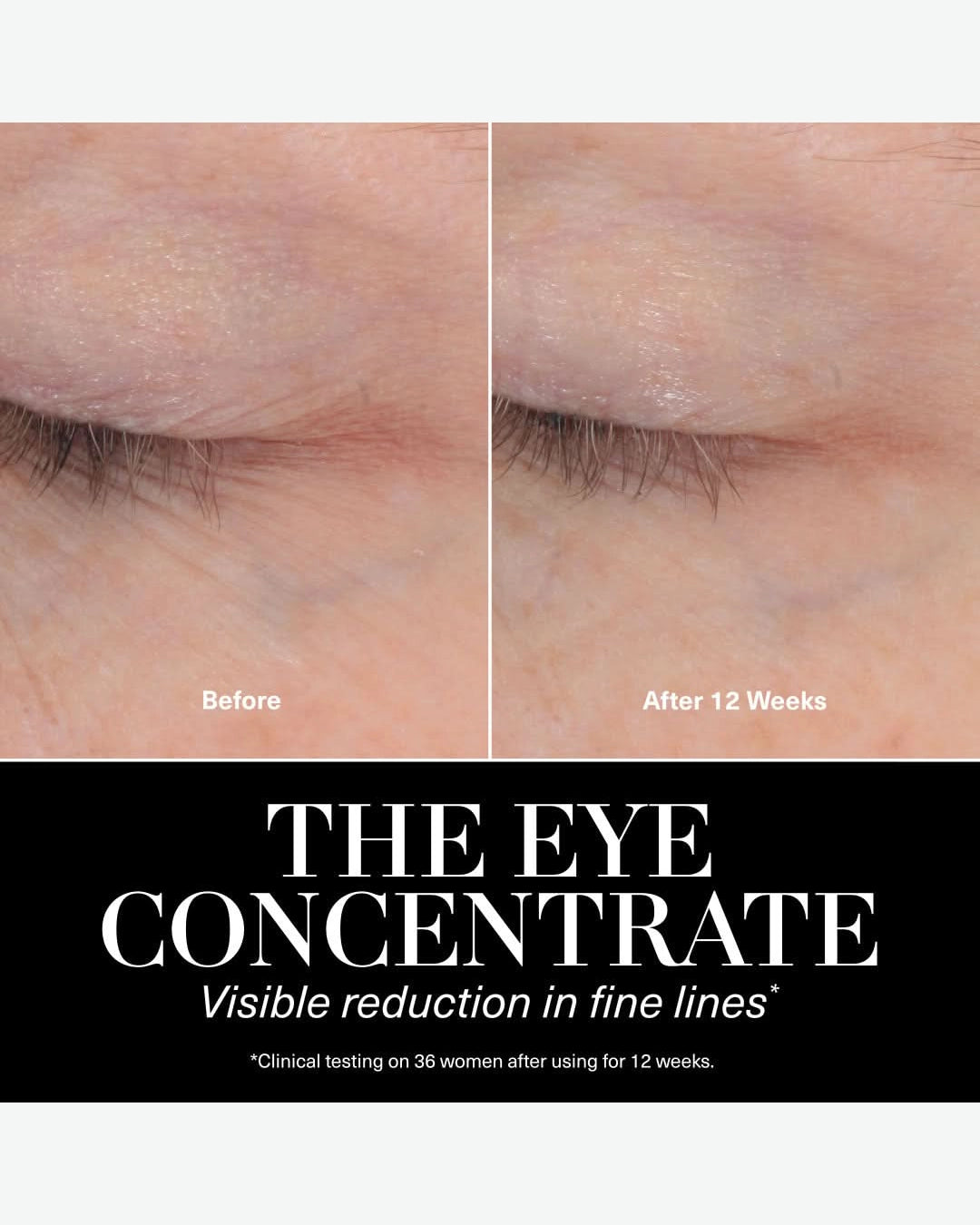 Eye Concentrate