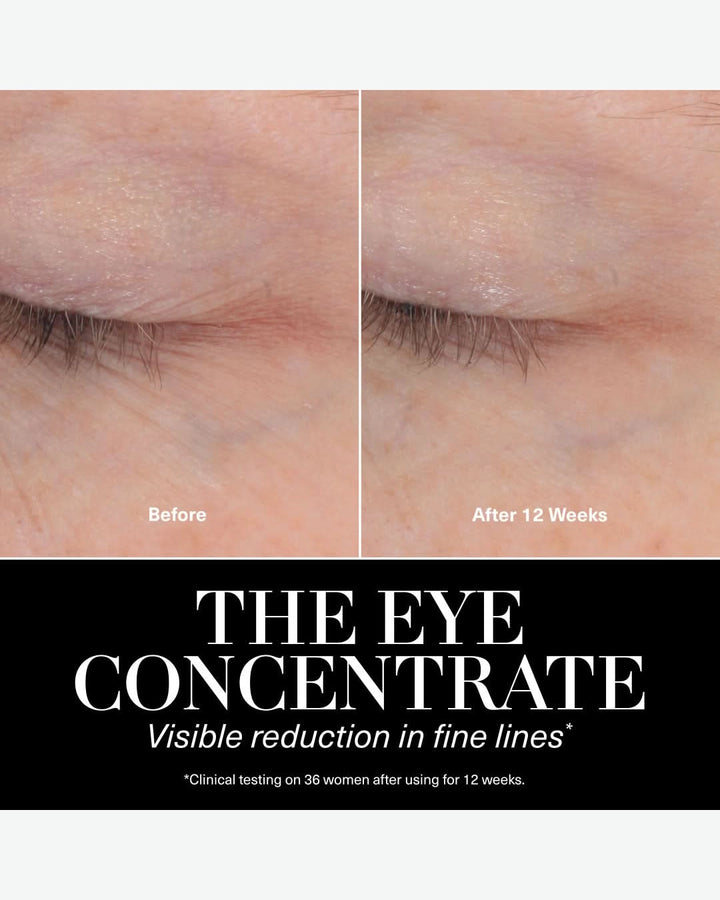 Eye Concentrate