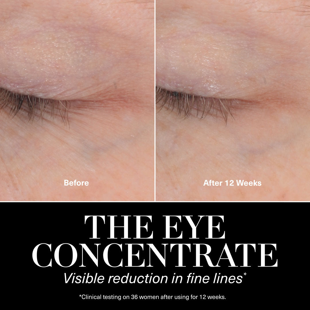 Eye Concentrate