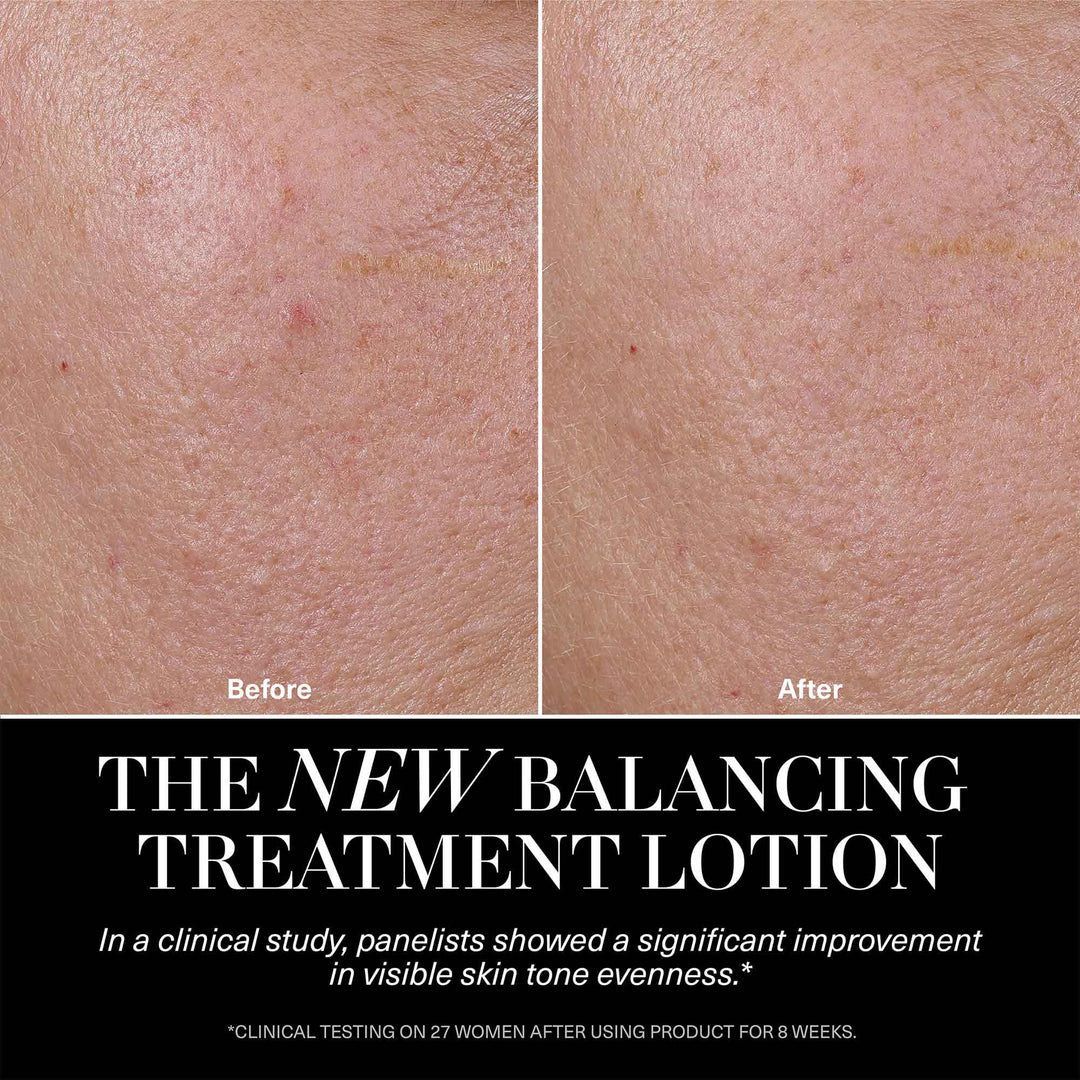 The Balancing Treatment Lotion