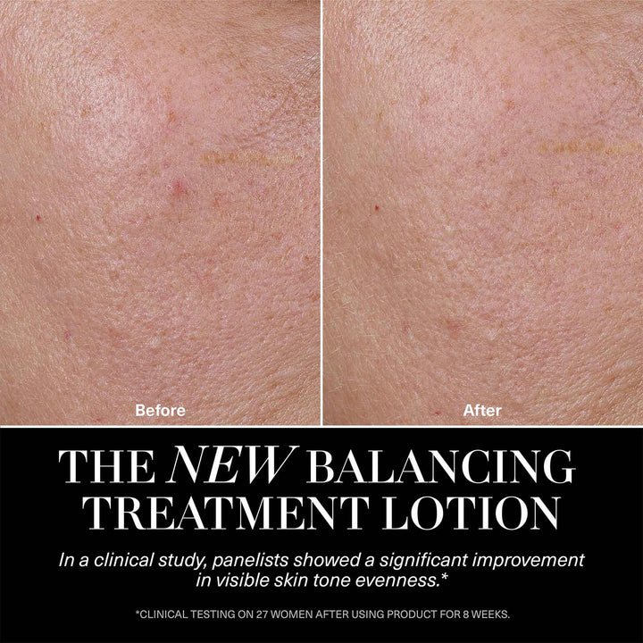 The Balancing Treatment Lotion