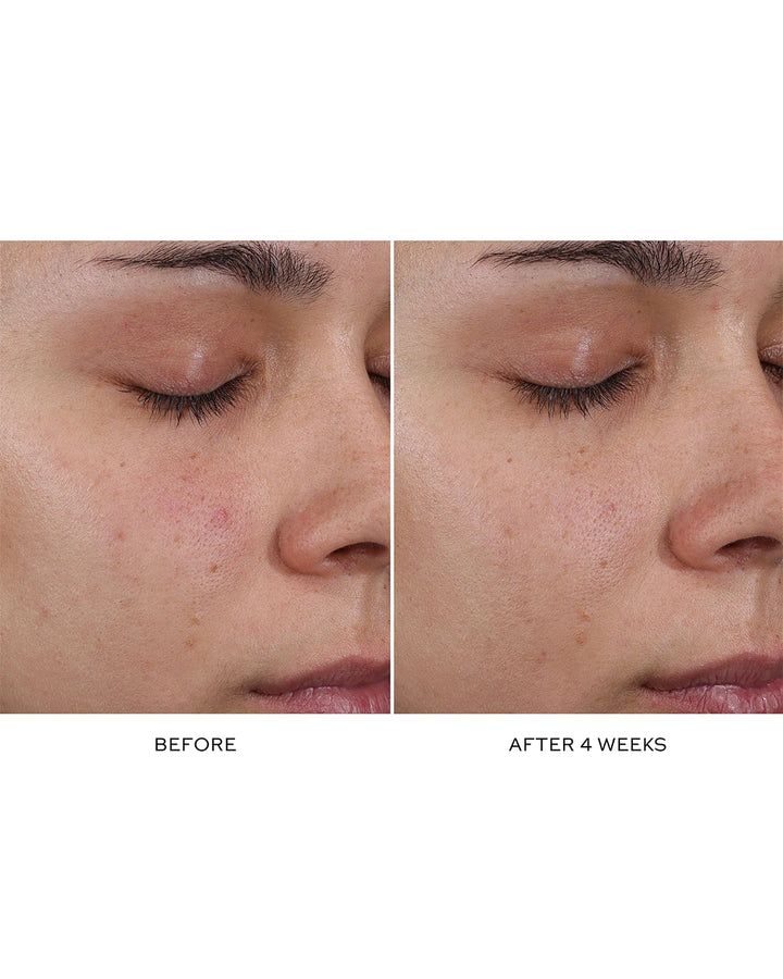 Pore Refining Complex