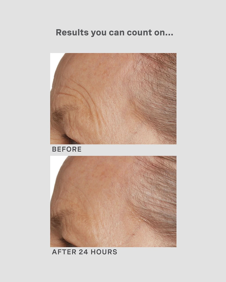 Before and after comparison of skin texture with text 'Results you can count on...' and 'After 24 Hours'.