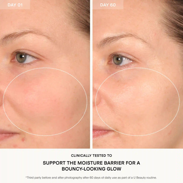 The Barrier Bioactive Treatment Mask