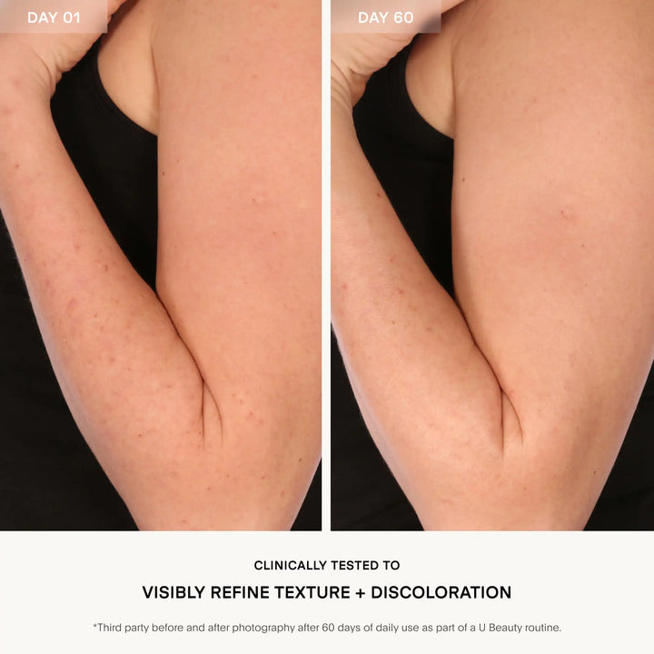 The Resurfacing Body Compound