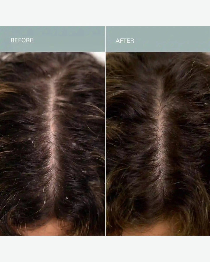 Before and after comparison of hair treatment on a person's head.