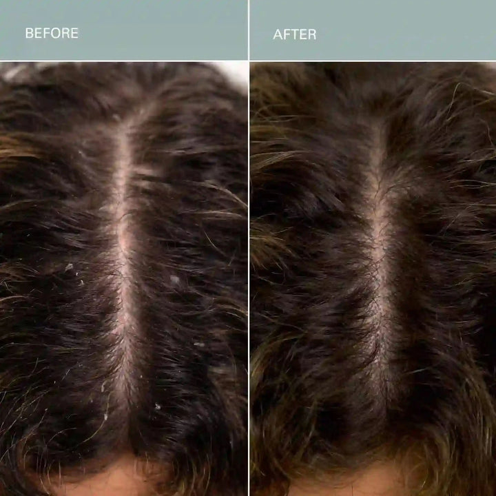 Salt Scalp Scrub Exfoliating Shampoo