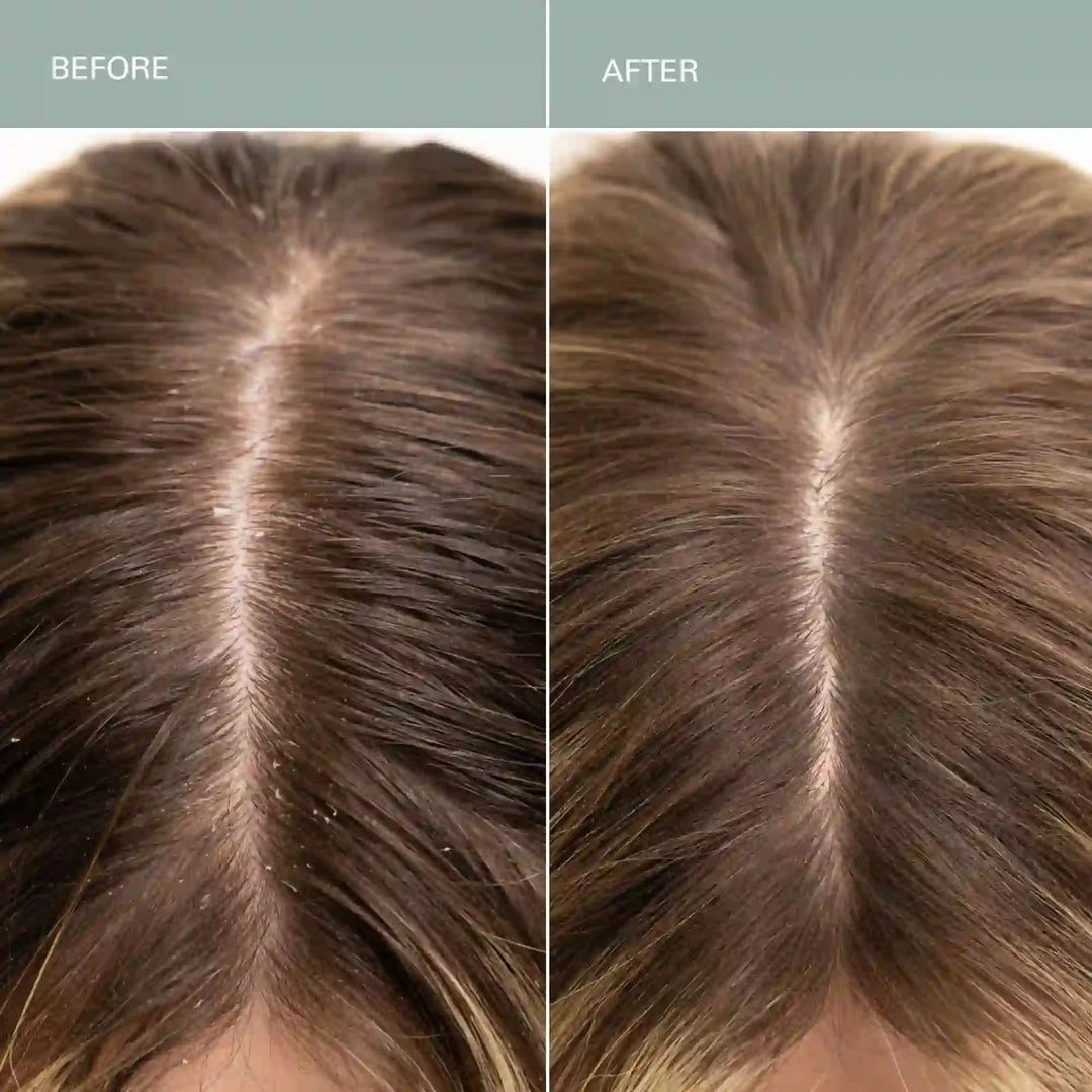 Salt Scalp Scrub Exfoliating Shampoo