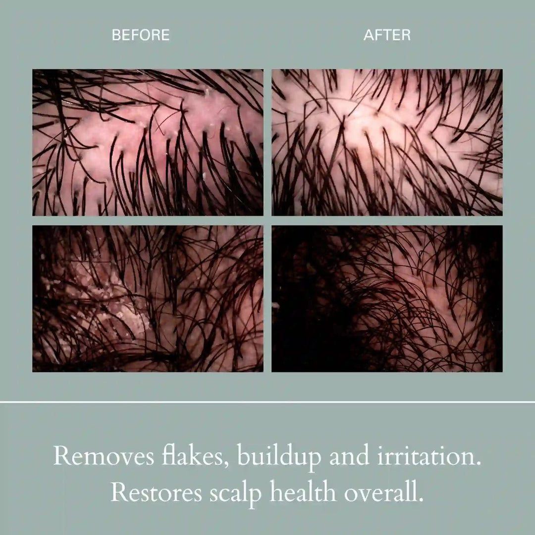 Salt Scalp Scrub Exfoliating Shampoo