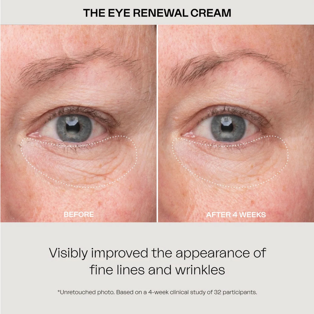 The Eye Renewal Cream 15 Ml