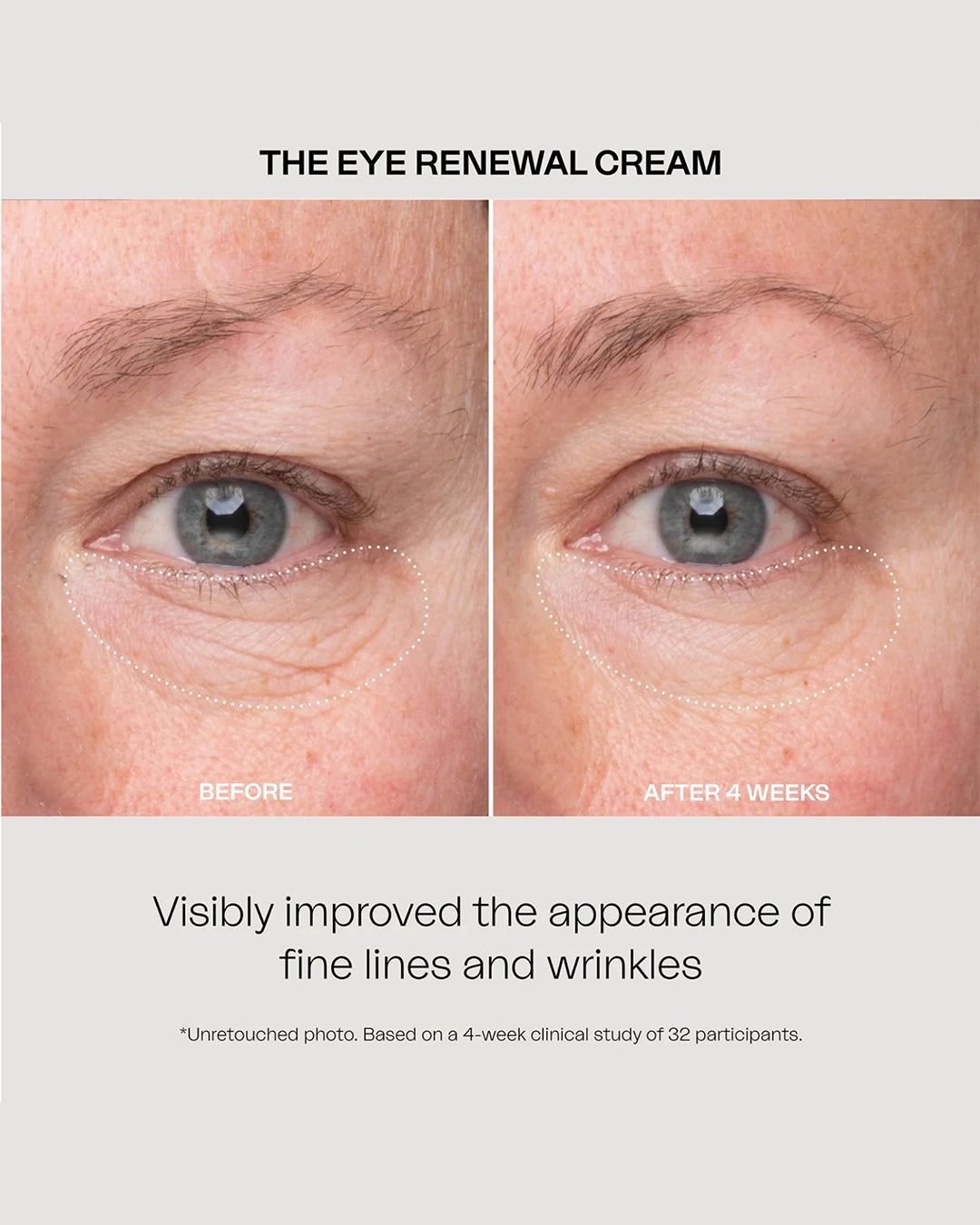The Eye Renewal Cream 15 Ml