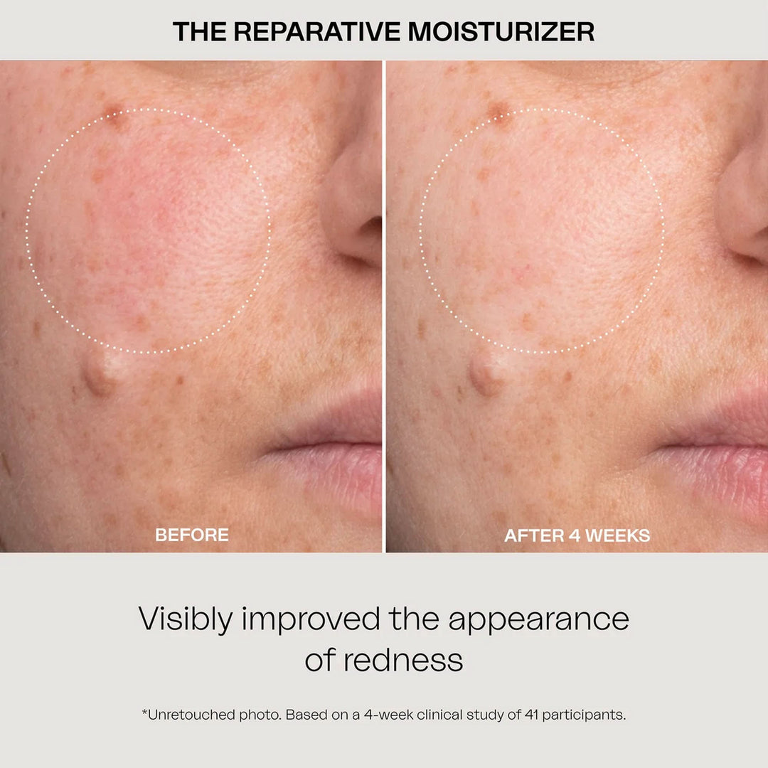 The Reparative Moisturizer 30 Ml