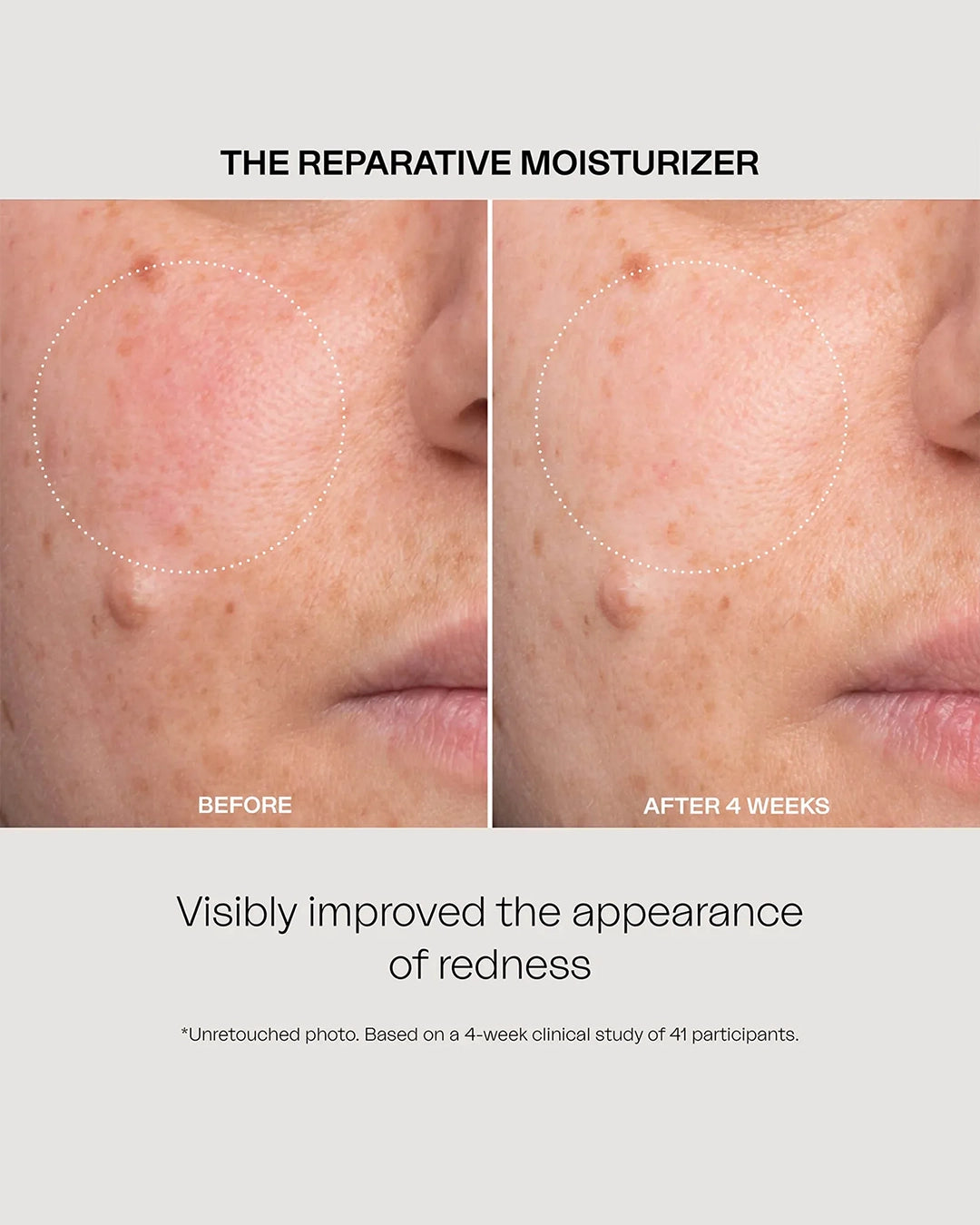 The Reparative Moisturizer 30 Ml
